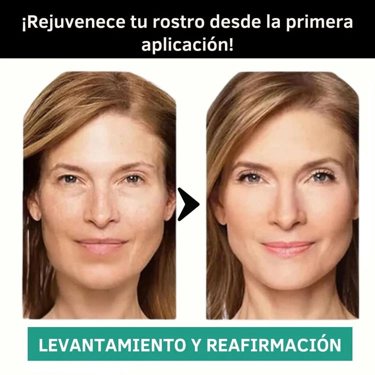 BeautyPatch™ - Parches de Colágeno Solubles - Reafirma y rejuvenece tu piel desde la primera semana