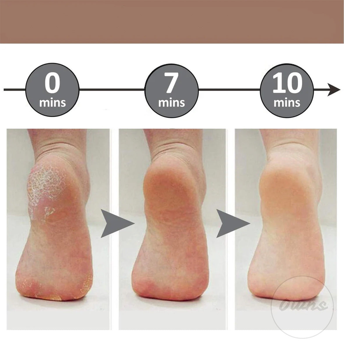 PediCare™ - Lima eléctrica recargable que elimina callos y deja tus pies suaves
