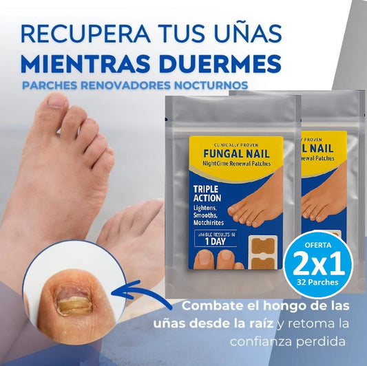Parches Antihongos OneNail™ – Elimina Hongos Fácilmente. Luce uñas limpias y fuertes