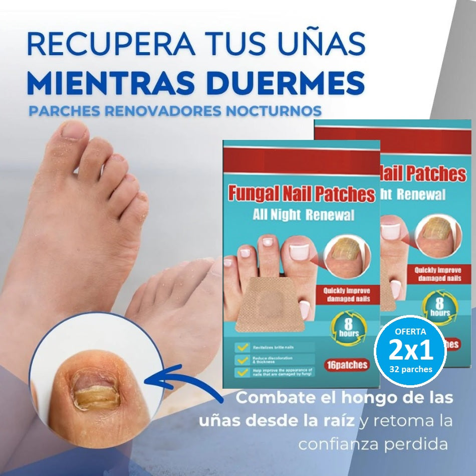 Parches Antihongos OneNail™ – Elimina Hongos Fácilmente. Luce uñas limpias y fuertes