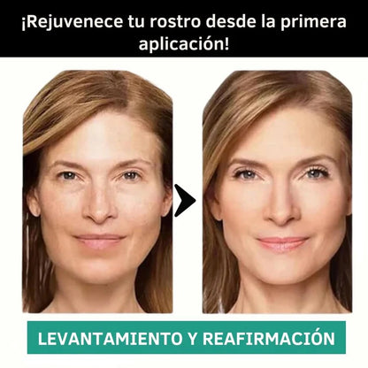 BeautyPatch™ - Parches de Colágeno Solubles - Reafirma y rejuvenece tu piel desde la primera semana