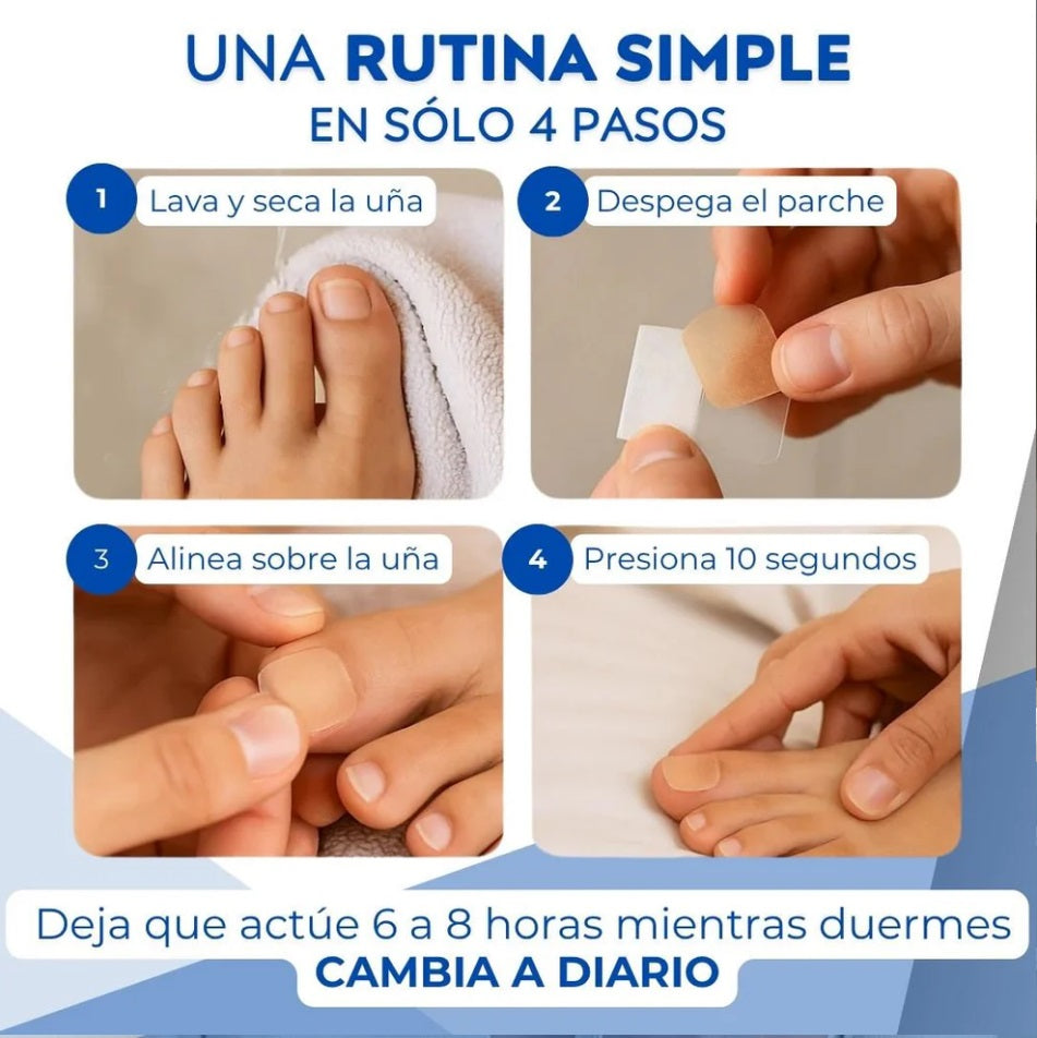 Parches Antihongos OneNail™ – Elimina Hongos Fácilmente. Luce uñas limpias y fuertes