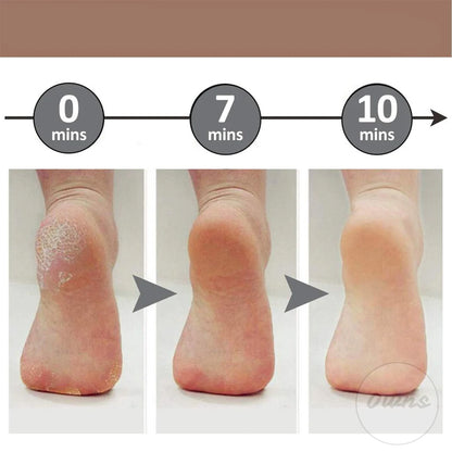 PediCare™ - Lima eléctrica recargable que elimina callos y deja tus pies suaves